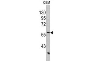 Western blot analysis of KRT10 antibody (Center) in CEM cell line lysates (35ug/lane). (Keratin 10 antibody  (Middle Region))