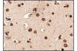 Immunohistochemistry of Rim3 in human brain tissue with this product at 2. (RIMS3 antibody  (N-Term))
