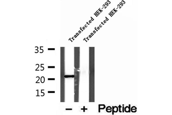 Glutathione Peroxidase 7 antibody  (Internal Region)