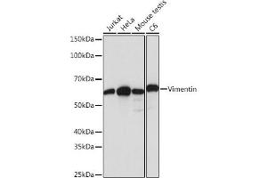 Western blot analysis of extracts of various cell lines, using Vimentin antibody (ABIN7271326) at 1:1000 dilution. (Vimentin antibody)