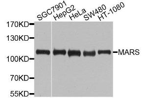 Western blot analysis of extracts of various cell lines, using MARS antibody (ABIN6003646) at 1/1000 dilution. (Mars (MARS) antibody)