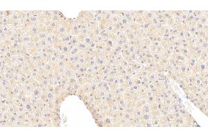 Detection of IGFBP4 in Mouse Liver Tissue using Polyclonal Antibody to Insulin Like Growth Factor Binding Protein 4 (IGFBP4) (IGFBP4 antibody  (AA 22-254))
