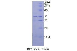 SDS-PAGE (SDS) image for Carbonic Anhydrase II (CA2) (AA 1-260) protein (His tag) (ABIN1879348)