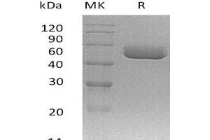 SERPINA1C Protein (His tag)