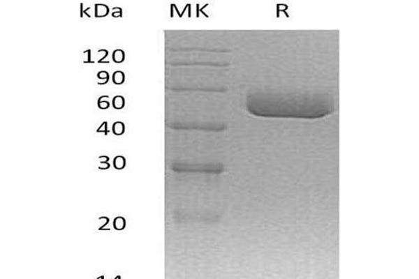 SERPINA1C Protein (His tag)