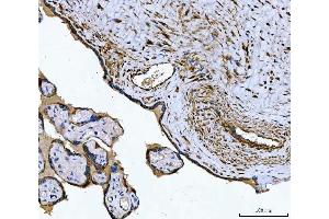 IHC analysis of Tropomyosin 2/TPM2 using anti-Tropomyosin 2/TPM2 antibody (ABIN7603245).