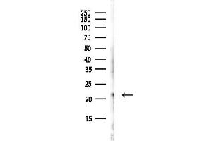 Western blot analysis of lysates from HepG2 cells(starvation, 24h treatment), using FTH1 Antibody at 1/1000 dilution.