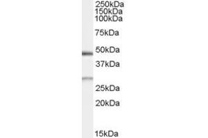 Western Blotting (WB) image for anti-BCL2/adenovirus E1B 19kDa Interacting Protein 1 (BNIP1) (AA 162-176) antibody (ABIN295942) (BNIP1 antibody  (AA 162-176))