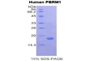 SDS-PAGE (SDS) image for Polybromo 1 (PBRM1) (AA 957-1086) protein (His tag) (ABIN1981204)