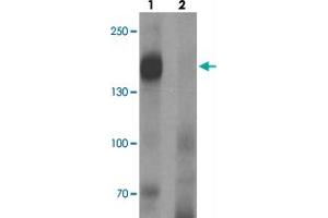 Western blot analysis of LNPEP in human lung tissue with LNPEP polyclonal antibody  at 1 ug/mL in (1) the absence and (2) the presence of blocking peptide.