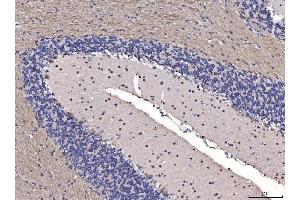IHC analysis of FGF2 using anti-FGF2 antibody (ABIN7603215). (FGF2 antibody  (N-Term))