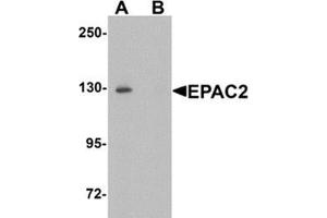 Western blot analysis of EPAC2 in rat liver tissue lysate with EPAC2 Antibody at 1 μg/ml in (A) the absence and (B) the presence of blocking peptide.