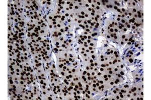 Image no. 2 for anti-Zinc Finger and SCAN Domain Containing 18 (ZSCAN18) antibody (ABIN1501861) (ZSCAN18 antibody)