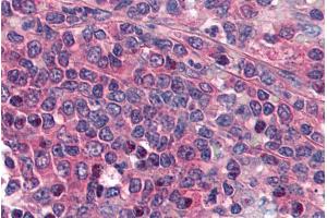 ABIN185589 (5µg/ml) staining of paraffin embedded Human Spleen. (PTGER1 antibody  (Internal Region))