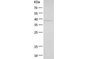 Western Blotting (WB) image for Activating Signal Cointegrator 1 Complex Subunit 1 (ASCC1) (AA 1-357) protein (His tag) (ABIN7287946) (ASCC1 Protein (AA 1-357) (His tag))