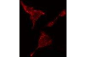 ABIN6278562 staining  HeLa cells by IF/ICC. (CTBP2 antibody  (C-Term))