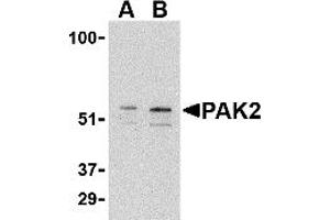 Western Blotting (WB) image for anti-P21-Activated Kinase 2 (PAK2) (C-Term) antibody (ABIN1030567) (PAK2 antibody  (C-Term))