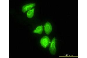 Immunofluorescence of monoclonal antibody to DNAJC3 on HeLa cell.