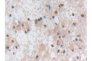 Immunohistochemistry (IHC) image for anti-Phospholamban (PLN) (AA 1-52) antibody (ABIN7442687)