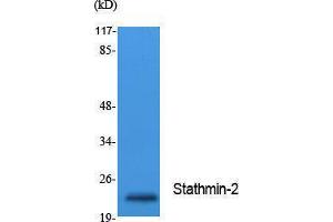 Western Blotting (WB) image for anti-Stathmin-Like 2 (STMN2) (Internal Region) antibody (ABIN3178107) (STMN2 antibody  (Internal Region))