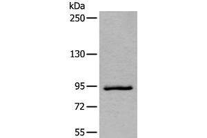 Western blot analysis of Jurkat cell lysate using ZBTB10 Polyclonal Antibody at dilution of 1:800