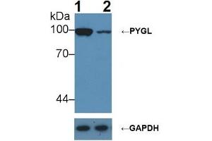Knockout Varification: ;Lane 1: Wild-type Hepg2 cell lysate; ;Lane 2: PYGL knockout Hepg2 cell lysate; ;Predicted MW: 97kDa ;Observed MW: 100kDa;Primary Ab: 1µg/ml Rabbit Anti-Rat PYGL Ab;Second Ab: 0. (PYGL antibody  (AA 341-509))