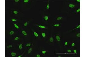 Immunofluorescence of purified MaxPab antibody to GTF3C2 on HeLa cell. (GTF3C2 antibody  (AA 1-911))