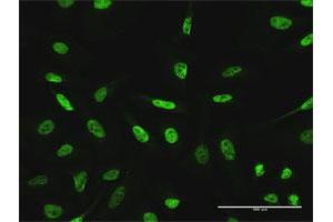 Immunofluorescence of purified MaxPab antibody to GTF3C2 on HeLa cell.