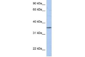 PRR18 antibody used at 1 ug/ml to detect target protein. (Proline Rich 18 antibody  (N-Term))