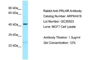 Western Blotting (WB) image for anti-Prolactin Releasing Hormone Receptor (PRLHR) (N-Term) antibody (ABIN2774413) (PRLHR antibody  (N-Term))