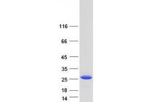 Validation with Western Blot (RCL Protein (Transcript Variant 1) (Myc-DYKDDDDK Tag))