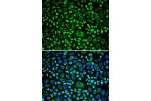 Immunofluorescence (IF) image for anti-TAP Binding Protein (Tapasin) (TAPBP) antibody (ABIN1875423)