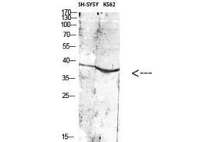 Western Blot (WB) analysis of specific cells using Antibody diluted at 1:1000. (ART1 antibody)
