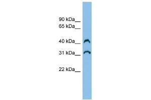 WB Suggested Anti-C3orf33 Antibody Titration: 0. (C3orf33 antibody  (Middle Region))