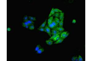 Immunofluorescent analysis of HepG2 cells using ABIN7170659 at dilution of 1:100 and Alexa Fluor 488-congugated AffiniPure Goat Anti-Rabbit IgG(H+L) (FDFT1 antibody  (AA 2-417))