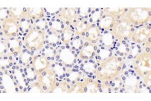 Detection of PAI1 in Human Kidney Tissue using Monoclonal Antibody to Plasminogen Activator Inhibitor 1 (PAI1) (PAI1 antibody)