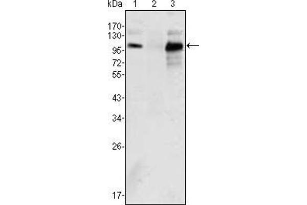 Androgen Receptor antibody