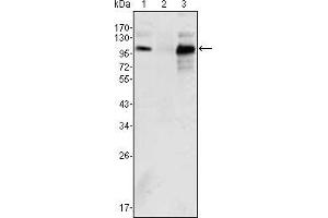 Western blot analysis using Androgen receptor mouse mAb against K562 (1), Jurkat (2) and LNCaP (3) cell lysate.