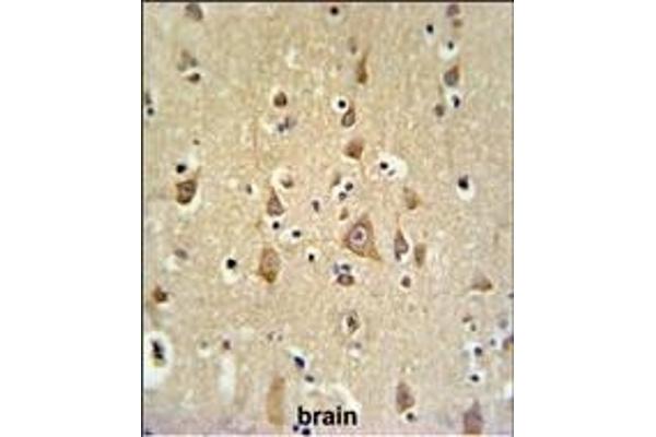 BOD1 antibody  (C-Term)
