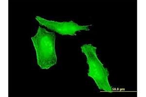 Immunofluorescence of monoclonal antibody to HRSP12 on HeLa cell. (HRSP12 antibody  (AA 1-137))