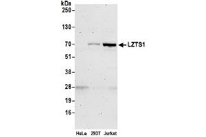 Western Blotting (WB) image for anti-Leucine Zipper, Putative Tumor Suppressor 1 (LZTS1) (AA 500-550) antibody (ABIN7450430)