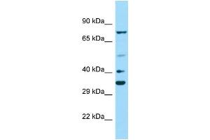 Host: Rabbit Target Name: PAX2 Sample Type: MCF7 Whole Cell lysates Antibody Dilution: 1. (PAX2A antibody  (Middle Region))
