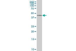 ZNF24 monoclonal antibody (M02), clone 2G5 Western Blot analysis of ZNF24 expression in Hela S3 NE . (ZNF24 antibody  (AA 1-368))