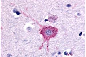 Anti-GRM2 / MGLUR2 antibody  ABIN1048928 IHC staining of human brain, neurons and glia. (GRM2 antibody  (N-Term))