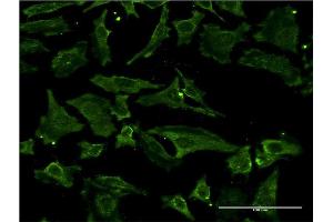 Immunofluorescence (IF) image for anti-Metalloproteinase Inhibitor 2 (TIMP2) (AA 27-220) antibody (ABIN948564)