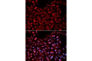 Immunofluorescence analysis of U2OS cells using NR1I3 antibody. (NR1I3 antibody  (AA 103-352))