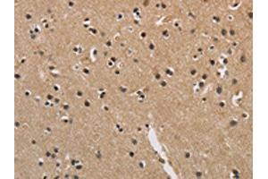 The image is immunohistochemistry of paraffin-embedded Human brain tissue using ABIN7128907(CENPN Antibody) at dilution 1/70. (CENPN antibody)