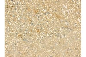 ABIN6262871 and ABIN6276592 at 1/100 staining human pituitary adenoma by IHC-P. (K-RAS antibody  (C-Term))