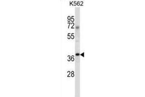 Western Blotting (WB) image for anti-NCK Adaptor Protein 1 (NCK1) antibody (ABIN2997496) (NCK1 antibody)