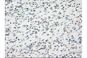 Image no. 2 for anti-Checkpoint Kinase 2 (CHEK2) antibody (ABIN1497495) (CHEK2 antibody)